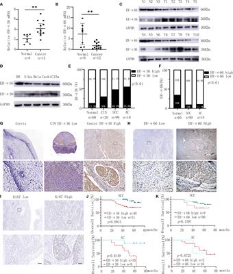 ER-α36 Promotes the Malignant Progression of Cervical Cancer Mediated by Estrogen via HMGA2